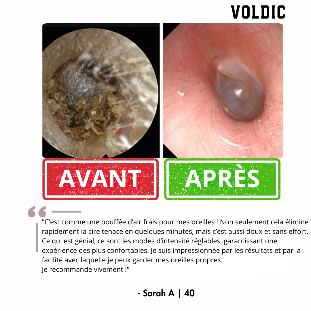 Voldic - Kit électrique de nettoyage des oreilles