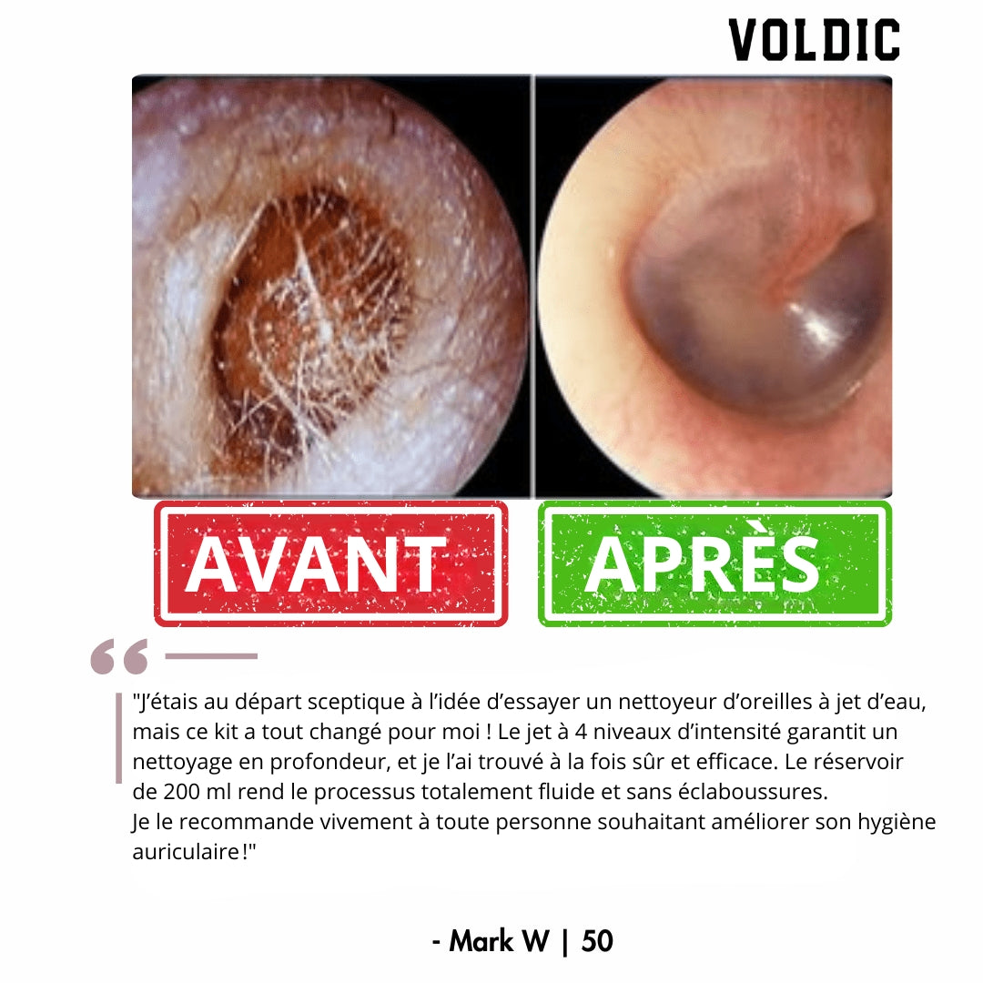 Voldic - Kit électrique de nettoyage des oreilles
