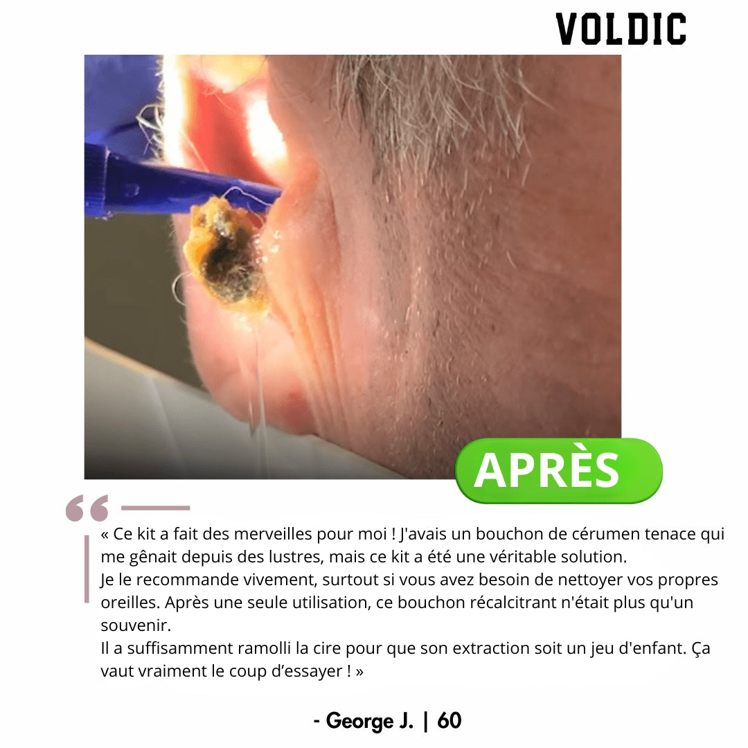 Voldic - Kit électrique de nettoyage des oreilles